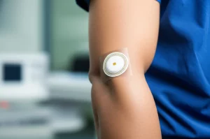 Immagine fotorealistica di un elettrodo ECG flessibile AgNRs-PDMS di nuova generazione applicato al braccio di un paziente in un ambiente clinico luminoso. Obiettivo prime 35mm, profondità di campo per mettere a fuoco l'elettrodo e il comfort sulla pelle. Colori naturali e vivaci.