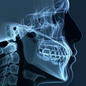 Visualizzazione 3D di una mandibola e delle vie aeree superiori, con indicazioni grafiche delle modifiche post-chirurgiche, illuminazione da studio per massima chiarezza, focale 60mm macro, su sfondo blu scuro e grigio duotone per un look scientifico moderno.