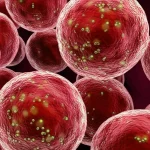 Immagine concettuale fotorealistica che mostra cellule polmonari infiammate (rosse e gonfie) accanto a cellule tumorali (scure e irregolari), con particelle luminose che rappresentano le molecole infiammatorie rilasciate durante la piroptosi che fungono da ponte tra le due condizioni. Utilizzare un obiettivo macro 90mm con profondità di campo ridotta per sfocare lo sfondo e mettere a fuoco l'interazione cellulare, illuminazione drammatica.