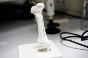 Un modello 3D fotorealistico della porzione prossimale di una tibia umana, stampato in materiale bianco, appoggiato su un tavolo da laboratorio medico. Illuminazione controllata, dettagli anatomici precisi, obiettivo macro da 60mm per evidenziare la texture e la forma.