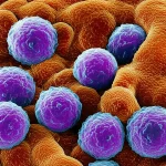 Immagine fotorealistica di macrofagi (TAM) che infiltrano un tumore solido, visualizzati al microscopio elettronico a scansione, obiettivo macro 105mm, alta definizione, illuminazione laterale per enfatizzare le texture cellulari, per rappresentare la complessità del microambiente tumorale e il ruolo dei TAM.