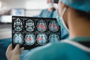 Photorealistic image of a neurosurgeon reviewing a brain MRI scan showing an abscess, 35mm portrait, depth of field, clinical setting, controlled lighting.