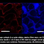 Visualizzazione al microscopio confocale di un nucleo cellulare, obiettivo 60mm macro, con il DNA colorato in blu (DAPI) che mostra regioni di diversa densità e i siti di danno al DNA indotti da oncogeni marcati in rosso (gamma-H2AX), concentrati nelle zone di eucromatina meno condensata. Illuminazione precisa, alta definizione dei dettagli.