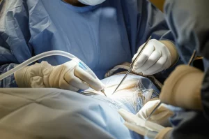 Primo piano di un anestesista esperto che esegue un blocco del piano serrato anteriore (SAPB) ecoguidato su un paziente in preparazione per una chirurgia toracoscopica video-assistita (VATS). L'immagine, scattata con un obiettivo prime da 50mm, cattura la concentrazione del medico e la tecnologia avanzata, con un'illuminazione da sala operatoria che evidenzia i dettagli della procedura. Duotone seppia e blu per un effetto clinico ma rassicurante.