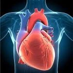 Illustrazione medica fotorealistica che mostra un cuore umano con evidenziata la radice aortica dilatata (aneurisma) e una dissezione nell'aorta toracica discendente, simboleggiando la complessità del caso di Sindrome di Turner. Prime lens, 35mm, depth of field, dramatic lighting.