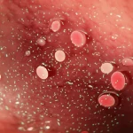 Un'immagine concettuale di un idrogel termosensibile iniettabile che rilascia batteri ricombinanti (Mycobacterium smegmatis esprimenti IL-15) all'interno della cavità addominale per combattere le metastasi tumorali. Macro lens, 105mm, high detail, precise focusing, controlled lighting per evidenziare la texture dell'idrogel e la dispersione dei batteri in un ambiente che simula l'interno del corpo.