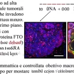 Immagine macro ad alta definizione di cellule tumorali epatiche (HCC) che invadono aggressivamente il tessuto circostante sano. In primo piano, dettagli molecolari evidenziati con fluorescenza: la proteina FTO appare ridotta (colore debole/blu) mentre le modificazioni m6A sull'RNA sono abbondanti (punti luminosi/rossi). Illuminazione drammatica e controllata, obiettivo macro 100mm, alta profondità di campo per mostrare l'invasione.