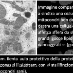 Immagine comparativa al microscopio elettronico: a sinistra una cellula epatica sana con mitocondri ben definiti e funzionali, a destra una cellula epatica affetta da steatosi con grandi gocce lipidiche e mitocondri danneggiati (gonfi, con creste alterate), evidenziando il ruolo protettivo della proteina HINT2 (magari con un'icona stilizzata vicino ai mitocondri sani). Lente macro 100mm, alta definizione, illuminazione da laboratorio.