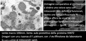 Immagine comparativa al microscopio elettronico: a sinistra una cellula epatica sana con mitocondri ben definiti e funzionali, a destra una cellula epatica affetta da steatosi con grandi gocce lipidiche e mitocondri danneggiati (gonfi, con creste alterate), evidenziando il ruolo protettivo della proteina HINT2 (magari con un'icona stilizzata vicino ai mitocondri sani). Lente macro 100mm, alta definizione, illuminazione da laboratorio.
