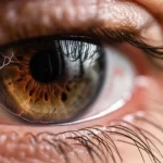 Photorealistic image, macro lens, 60mm, high detail, precise focusing, controlled lighting, photorealistic image of a human eye showing subtle signs of dry eye and a representation of damaged corneal nerves overlayed.