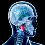Visualizzazione 3D fotorealistica di un impianto CeLFI posizionato con precisione all'interno di un'articolazione facciale cervicale umana, mostrando l'espansione anteriore e l'effetto di decompressione sul forame neurale, illuminazione drammatica, obiettivo 35mm con profondità di campo.