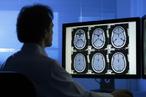 A radiologist examining a brain MRI scan on a large screen in a dimly lit room, 35mm portrait, depth of field.