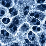 Immagine fotorealistica al microscopio elettronico di cellule di carcinoma squamoso della laringe, con proteine dell'ubiquitina (visualizzate come piccole particelle brillanti) evidenziate mentre interagiscono con le intricate strutture cellulari. Dettaglio elevato, obiettivo macro 105mm, illuminazione laterale drammatica per enfatizzare le texture e la profondità, bianco e nero con un duotono blu scuro per le ubiquitine.