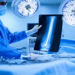 Fotografia realistica di una sala operatoria high-tech, focus su un chirurgo ortopedico che esamina una radiografia di una tibia distale con pseudoartrosi, con un chiodo endomidollare retrogrado visibile su un tavolo sterile. Obiettivo prime 35mm, profondità di campo, illuminazione drammatica con toni blu e grigi per un'atmosfera seria ma speranzosa.
