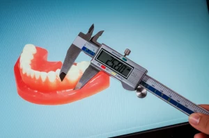 Primo piano di un modello dentale tridimensionale digitale visualizzato su uno schermo di computer, con un calibro digitale accanto per confronto. L'immagine è scattata con un obiettivo macro da 90mm, alta definizione, illuminazione da studio per enfatizzare le texture e i dettagli del modello digitale e del calibro.