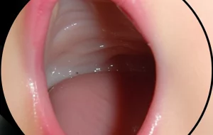 Immagine macro ad alta definizione di una laringe infantile visualizzata tramite endoscopio, con illuminazione chirurgica che evidenzia le pliche ariepiglottiche e l'epiglottide, illustrando l'anatomia rilevante per la laringomalacia. Obiettivo macro 100mm, messa a fuoco precisa.