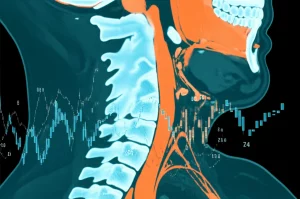 Immagine concettuale che combina una scansione TC del collo umano con grafici di dati sovrapposti che mostrano un trend positivo, prime lens 35mm, colori caldi e freddi in duotone (es. arancione e ciano) per rappresentare dati e biologia, profondità di campo che sfoca lo sfondo.