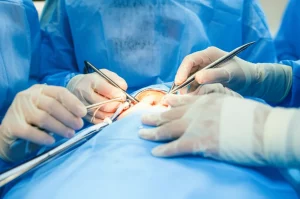 Immagine fotorealistica di una sala operatoria pediatrica, focus su un intervento laparoscopico assistito con tecnica a singola incisione (SILS) per diverticolo di Meckel, obiettivo prime 35mm, profondità di campo che sfoca leggermente lo sfondo mettendo in risalto l'area ombelicale con la strumentazione chirurgica minimamente invasiva, illuminazione controllata.