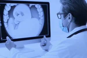 Un medico specialista esamina attentamente un'immagine di colonscopia su uno schermo ad alta risoluzione in un ambiente clinico moderno. L'immagine è un ritratto professionale scattato con un obiettivo prime da 35mm, utilizzando una profondità di campo ridotta per focalizzare l'attenzione sul medico e sullo schermo. La scena è illuminata con toni duotone blu e grigi per un aspetto clinico ma sofisticato.