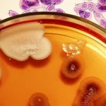 Immagine fotorealistica, macro lens 70mm, high detail, precise focusing, che raffigura una piastra di Petri con colonie mucoidi e brillanti di Bacillus cereus MSS1 isolate da sedimento marino, sottilmente sovrapposta o giustapposta a una vista microscopica di cellule di cancro al colon che mostrano segni di apoptosi, simboleggiando la connessione tra la scoperta marina e il suo potenziale terapeutico.