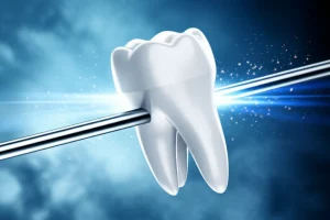 Immagine concettuale di un trattamento ortodontico accelerato: un dente canino stilizzato che si muove rapidamente lungo un filo ortodontico, con piccole scintille o effetti di luce che simboleggiano le micro-osteoperforazioni. Sfondo astratto high-tech blu e argento. Obiettivo macro 100mm, illuminazione drammatica, alta definizione, controlled lighting.