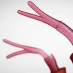 Fotografia macro ad alta definizione di un cordone ombelicale neonatale con una rara anomalia: tre arterie e una vena visibili. Illuminazione da studio controllata, obiettivo macro 90mm, focus preciso sui vasi sanguigni, sfondo neutro sfocato.