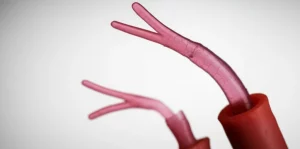 Fotografia macro ad alta definizione di un cordone ombelicale neonatale con una rara anomalia: tre arterie e una vena visibili. Illuminazione da studio controllata, obiettivo macro 90mm, focus preciso sui vasi sanguigni, sfondo neutro sfocato.