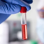 Photorealistic image of a medical researcher holding a vial of liquid, representing a blood sample for ctDNA analysis, with a blurred background showing a lab environment. Macro lens, 60mm, high detail, precise focusing, controlled lighting.