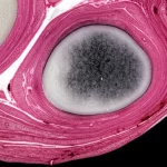 Immagine macro ad alta definizione di un disco intervertebrale umano sezionato, che mostra chiaramente la degenerazione del nucleo polposo (più scuro, disidratato) rispetto all'anulus fibroso circostante. Illuminazione drammatica da laboratorio che enfatizza la texture e i dettagli della struttura danneggiata, 100mm Macro lens, focus preciso.