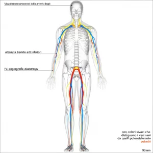 Visualizzazione 3D avanzata delle arterie degli arti inferiori ottenuta tramite TC angiografia dual-energy, con colori vivaci che distinguono i vasi sani da quelli potenzialmente ostruiti, obiettivo macro 90mm, alta definizione, illuminazione drammatica per enfatizzare la complessità del sistema vascolare.