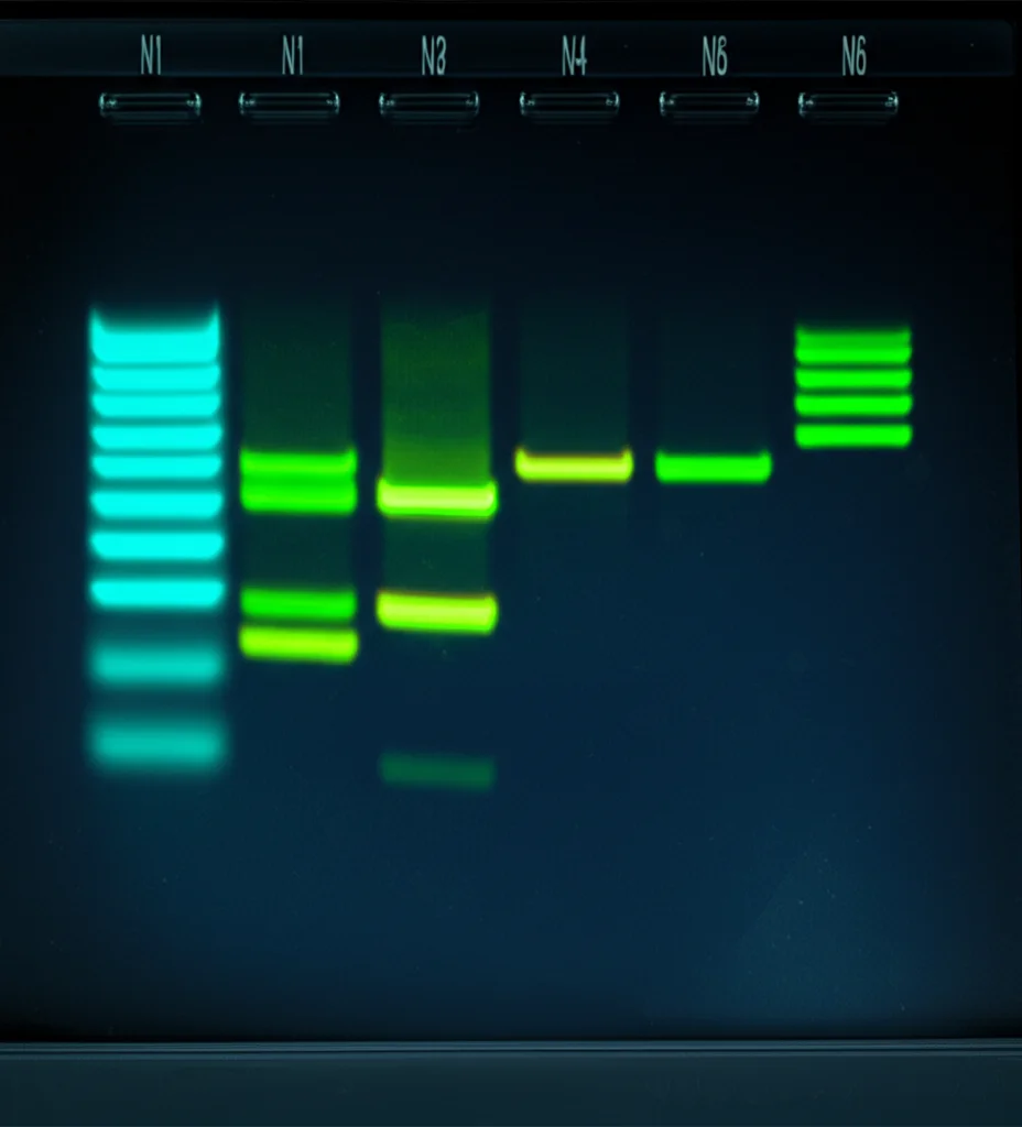 Immagine fotorealistica di un gel di elettroforesi con bande di DNA fluorescenti chiaramente segmentate da un'intelligenza artificiale, sovrapposizione grafica high-tech che evidenzia le bande riconosciute, obiettivo macro 100mm, alta definizione, illuminazione drammatica e controllata per enfatizzare il contrasto.