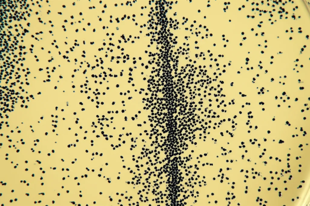 Macro fotografia di cisti di Acanthamoeba su una piastra di Petri, con nanoparticelle magnetiche visibili che aderiscono alle cisti. Luce da laboratorio controllata, alta definizione, obiettivo macro 100mm.