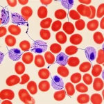 A highly detailed macro shot of a lab slide showing Plasmodium falciparum parasites inside red blood cells, viewed under a microscope, with precise focusing and controlled lighting.