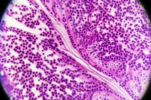 Macro lens shot, 90mm, di pattern vorticosi in una provetta contenente un campione di plasma sanguigno, alta definizione, messa a fuoco precisa, illuminazione controllata da laboratorio, che suggerisce un'analisi molecolare complessa legata agli sfingolipidi e all'invecchiamento.