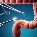 Un'immagine concettuale che rappresenta la complessità della chirurgia intestinale e il rischio di infezioni. Potrebbe essere una visualizzazione stilizzata di un intestino con aree evidenziate che indicano potenziale infezione, con strumenti chirurgici sfocati sullo sfondo. Illuminazione drammatica, obiettivo macro 100mm per dettagli precisi sulle aree 'infette' simulate.