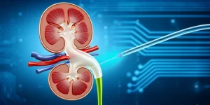 Un'immagine concettuale di un rene umano stilizzato con nervi evidenziati, uno dei quali viene selettivamente 'disattivato' da un fascio di luce proveniente da un catetere. Sfondo medico-scientifico high-tech, illuminazione cinematografica, profondità di campo. Obiettivo 35mm.