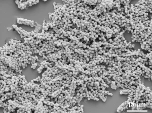 Fotografia ad alto dettaglio di particolato atmosferico (PM2.5) visto al microscopio elettronico, evidenziando la complessa morfologia e composizione mista di particelle organiche e inorganiche (solfati/organosolfati), illuminazione scientifica controllata, obiettivo macro 105mm, alta definizione.