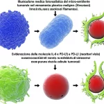 Illustrazione medica fotorealistica del microambiente tumorale nel versamento pleurico maligno, con cellule tumorali polmonari (grigie), cellule immunitarie (linfociti T in blu e macrofagi in giallo) e fibroblasti associati al cancro (verdi filamentosi). Evidenziazione delle molecole IL-6 (piccole sfere rosse) e PD-L1 (recettori viola sulle cellule tumorali). Obiettivo macro 100mm, illuminazione controllata, alta definizione, profondità di campo per un effetto tridimensionale.