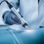 Immagine fotorealistica di una sonda per imaging fotoacustico avanzata mentre viene utilizzata delicatamente sul collo di un paziente in un ambiente ospedaliero high-tech. La luce laser emessa dalla sonda è visibile come un fascio sottile che interagisce con il tessuto. Prime lens, 35mm, depth of field, duotone blu e grigio per un effetto clinico ma rassicurante.