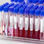 Immagine macro ad alta definizione di provette di sangue in un rack da laboratorio, con focus preciso sul plasma separato e sulle etichette. Illuminazione controllata da studio per evidenziare i dettagli. Obiettivo macro 100mm.