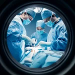 A medical team in an operating room, focused on a long bone procedure, representing surgical treatment for fibrous dysplasia. Prime lens, 35mm, depth of field, duotone blue and grey, capturing the intensity and precision of the surgery.