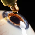 Immagine fotorealistica, obiettivo macro 100mm, che cattura una singola goccia di soluzione antibiotica mentre cade verso una rappresentazione stilizzata di un occhio, simboleggiando il trattamento mirato contro un'infezione come l'endoftalmite da Klebsiella. Illuminazione controllata, alto dettaglio.