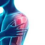 Immagine concettuale fotorealistica che mostra una figura umana stilizzata con un'area di dolore rosso vivo evidenziata sul braccio sinistro e sulla scapola, sovrapposta a una scansione polmonare traslucida che rivela una lesione fungina nell'apice sinistro. Obiettivo 35mm, profondità di campo che sfoca leggermente lo sfondo per concentrarsi sulla connessione tra dolore e infezione polmonare.