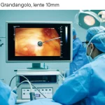 Grandangolo, lente 10mm, scena in sala operatoria focalizzata su un monitor che mostra un'ecografia epatica durante un'ablazione a microonde, team medico parzialmente visibile, messa a fuoco nitida sulla tecnologia, ambiente sterile.