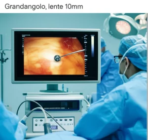 Grandangolo, lente 10mm, scena in sala operatoria focalizzata su un monitor che mostra un'ecografia epatica durante un'ablazione a microonde, team medico parzialmente visibile, messa a fuoco nitida sulla tecnologia, ambiente sterile.