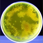 Primo piano con obiettivo macro da 60mm di una coltura di callo di Lotus arabicus L. in una piastra di Petri, con nanoparticelle di zolfo biosintetizzate visibili come una finissima polvere gialla sulla superficie del callo. L'illuminazione da laboratorio è controllata per evidenziare la texture cellulare del callo e l'interazione con le nanoparticelle, creando un'immagine scientifica dettagliata e ad alto impatto visivo.