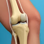Immagine fotorealistica di un ginocchio umano in sezione, che mostra chiaramente il Legamento Patello-Femorale Mediale (LPMP) ricostruito con la tecnica a doppio fascio. Macro lens, 70mm, alta definizione dei dettagli anatomici, illuminazione da studio controllata per evidenziare la struttura dei fasci. Sfondo pulito e leggermente sfocato per concentrare l'attenzione sul legamento.