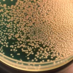 Immagine macro ad alta definizione di colonie di Helicobacter pylori in una piastra di Petri, obiettivo macro 90mm, illuminazione da laboratorio controllata per dettagli precisi, sfondo sfocato che suggerisce un ambiente di ricerca scientifica.