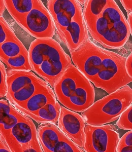 Microscopic view of kidney tubular cells under high glucose conditions, showing cellular stress and inflammation. Macro lens, 105mm, high detail, precise focusing.