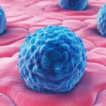 Visualizzazione artistica di cellule di carcinoma papillare tiroideo (blu) che infiltrano il tessuto mammario (rosa), immagine macro con lente da 60mm, alto dettaglio, schema di colori duotone per differenziare i tessuti, illuminazione controllata per un effetto drammatico ma scientifico.